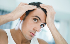 Perte de cheveux